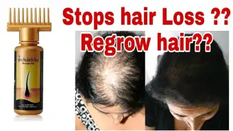 Indulekha Bhringa Hair Oil Buy Online At Best Prices In Nepal