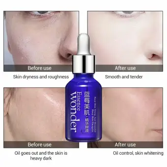 serum wonder bioaqua