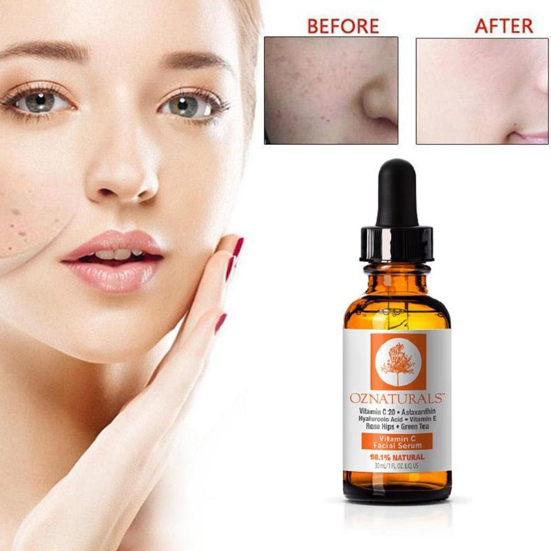 Face Serum Before And After | ubicaciondepersonas.cdmx.gob.mx